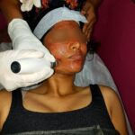 One day workshop on Microneedling